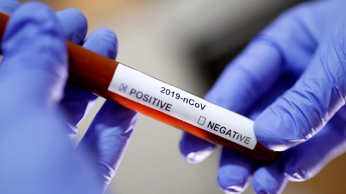 В Киеве зафиксировали 20 случаев инфицирования коронавирусом за последние сутки
