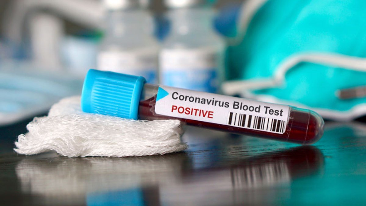 В каких случаях и какие врачи будут делать экспресс-тесты на коронавирус: алгоритм действий
