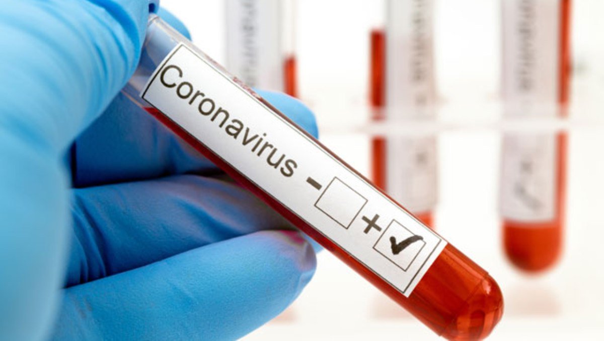 В Печерском и Дарницком районах больше всего случаев Covid-19 за сутки: карта заболеваемости коронавирусом на 15 апреля