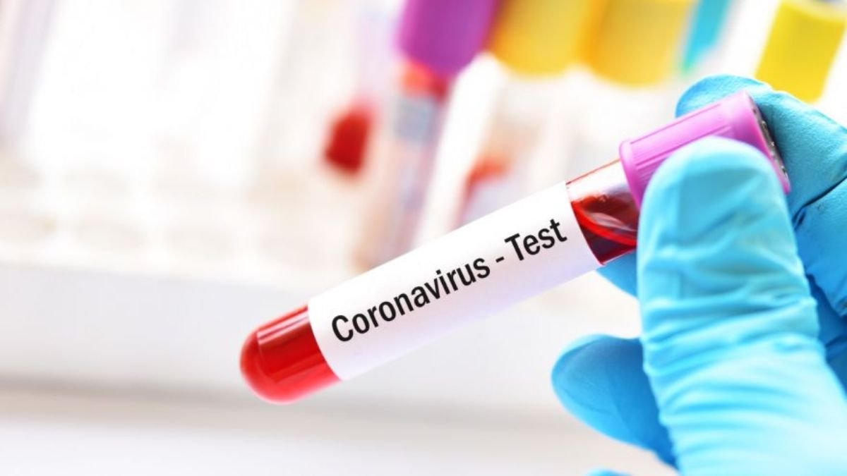 В Киеве за пасхальные сутки 49 новых случаев COVID-19: сколько человек болеет коронавирусом 20 апреля