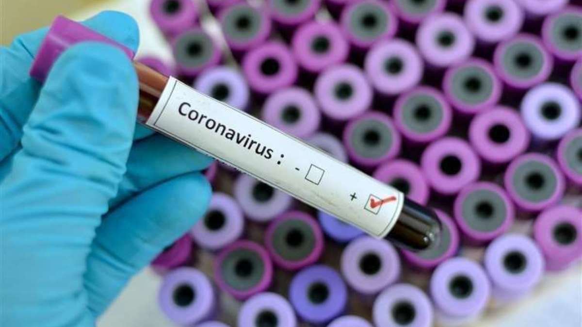 В Киеве 37 новых случаев COVID-19 за сутки, один человек умер: сколько человек болеют коронавирусом 25 апреля