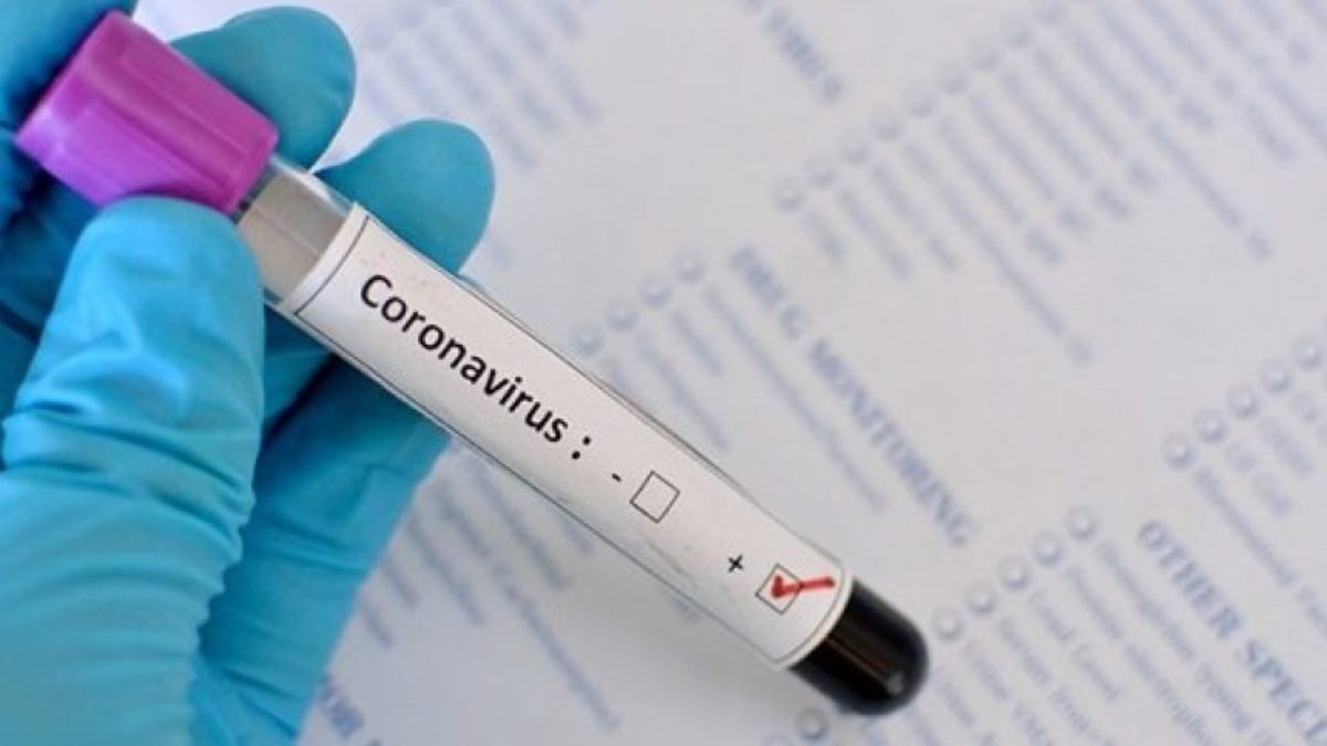 В Киеве за сутки 52 новых случая COVID-19, из них 11 медиков: сколько человек болеют коронавирусом 1 мая