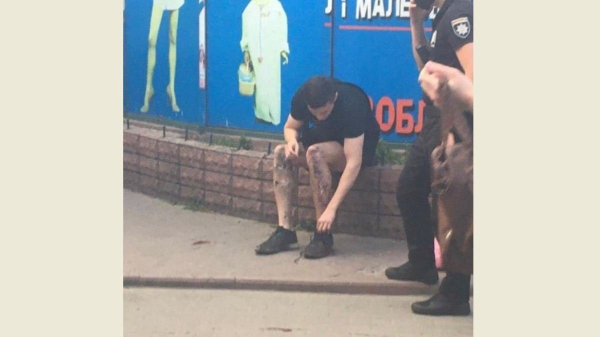 Взрыв в Киеве возле станции метро "Шулявская": пострадавшего студента прооперировали