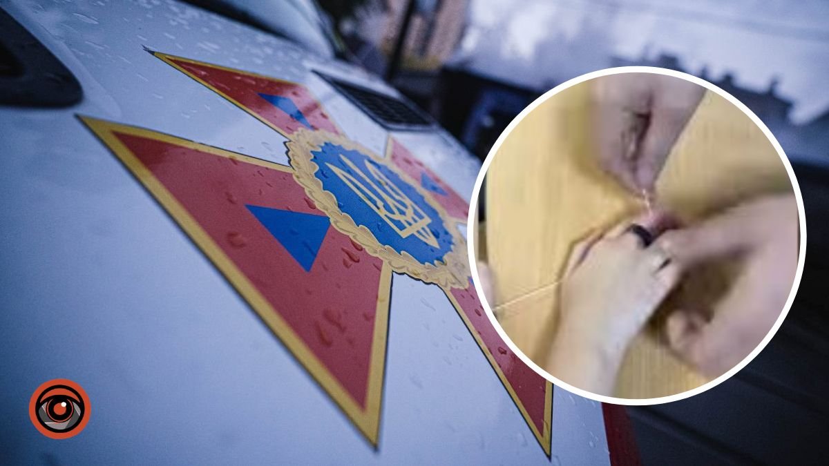 У Києві рятувальники допомогли хлопчику зняти каблучку з травмованого пальця