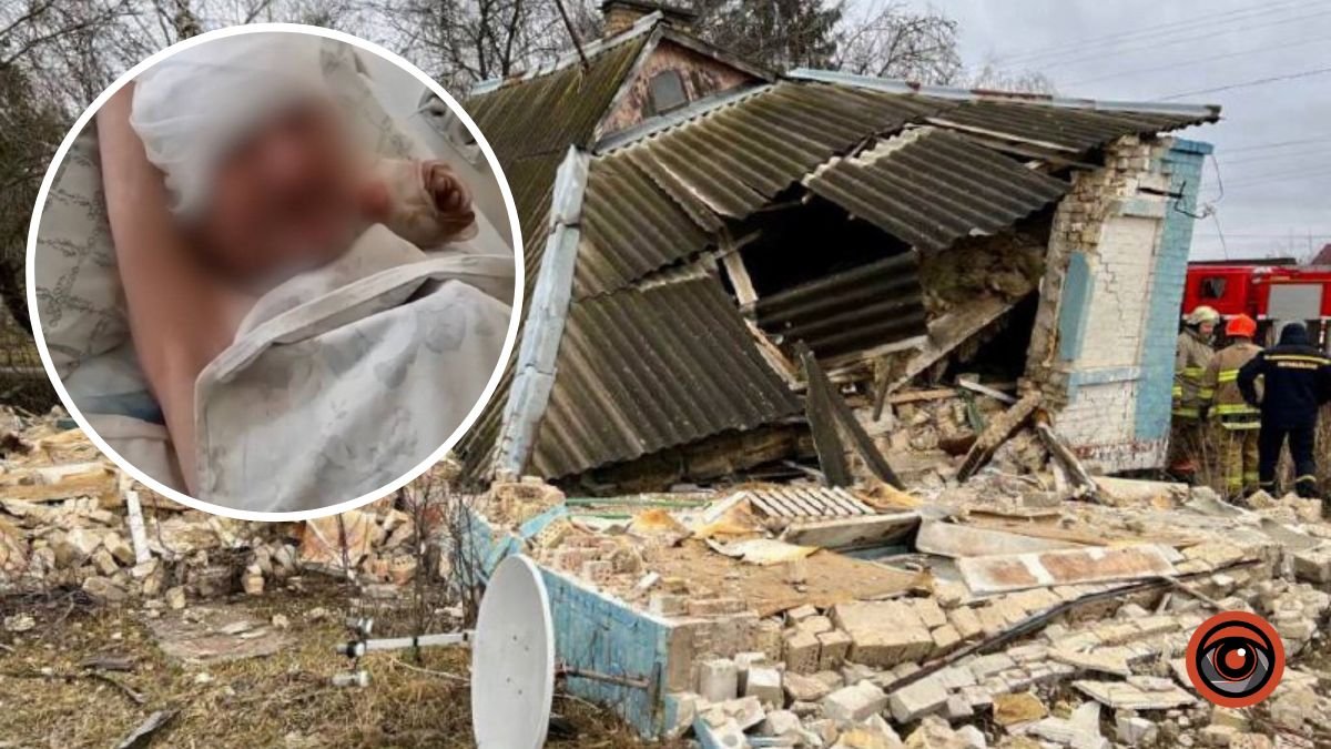 Запалив свічку і стався вибух: на Київщині власник будинку дивом вижив