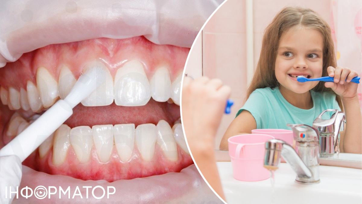 зуби стоматологія діти