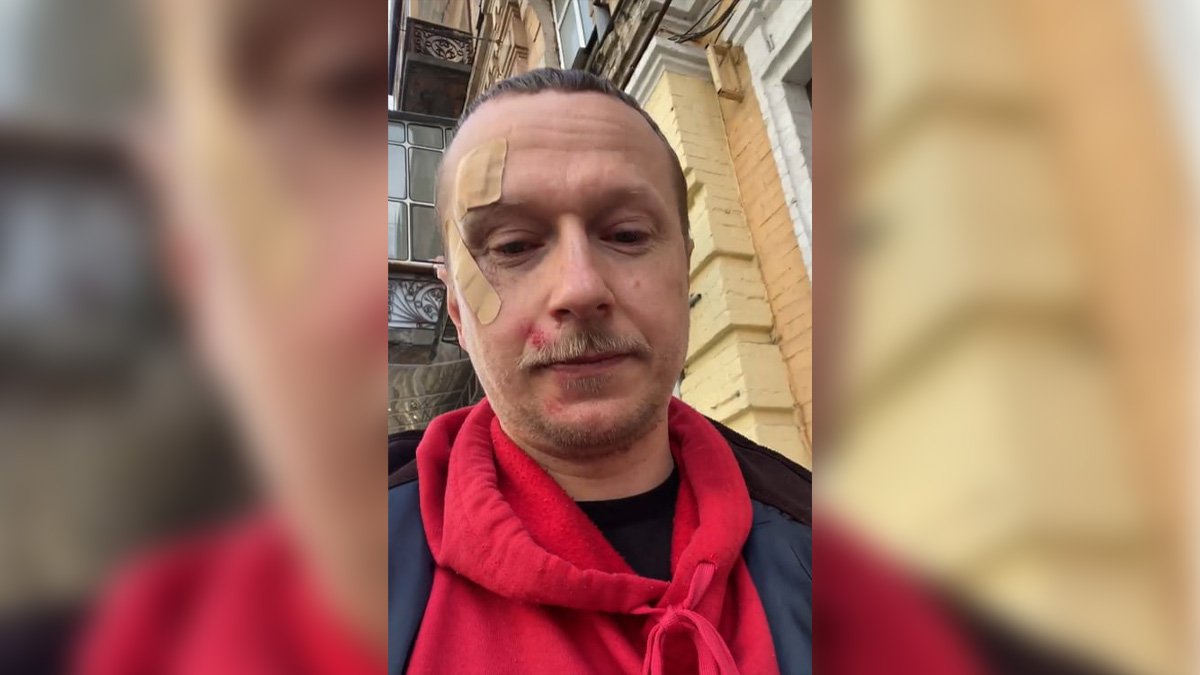 В Киеве избили тележурналиста, известного как Майкл Щур