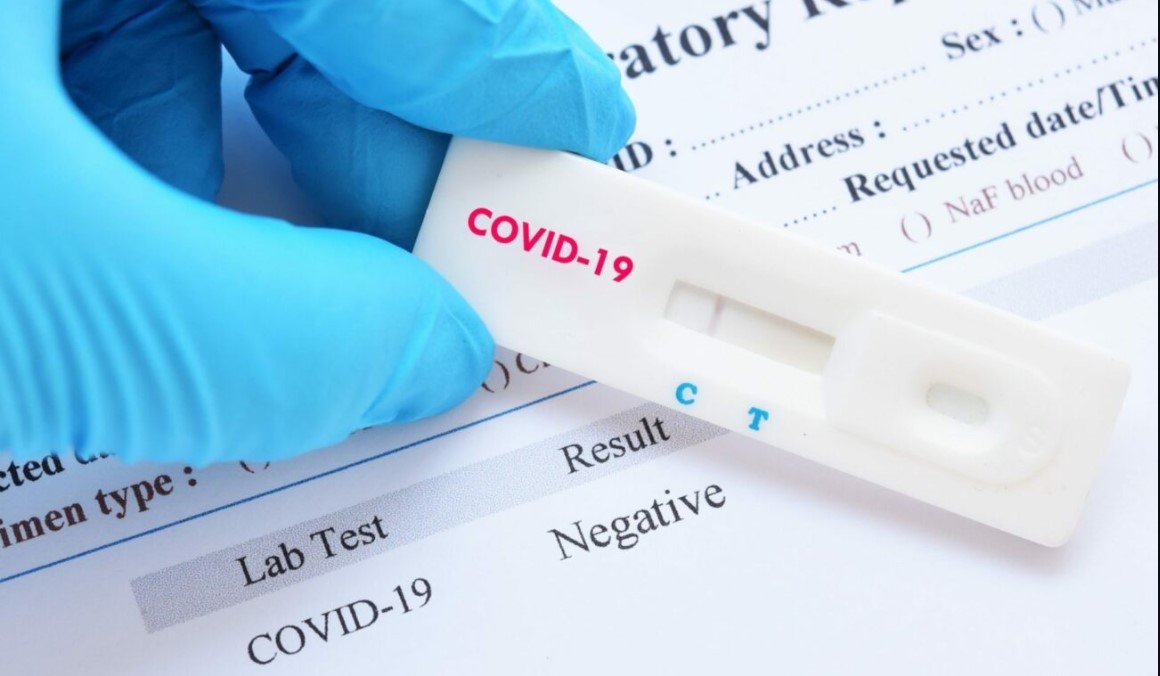 Во Франции отменили бесплатные COVID-тесты для невакцинированных