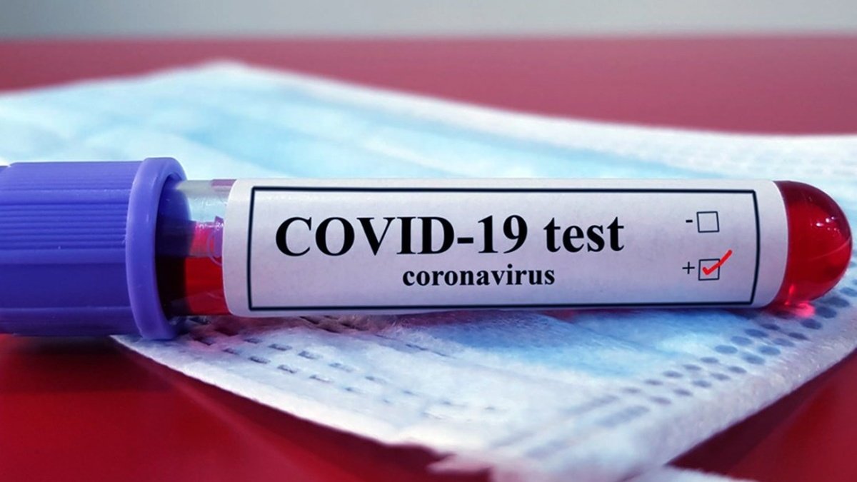 В Украине за сутки более 11 тысяч новых случаев COVID-19