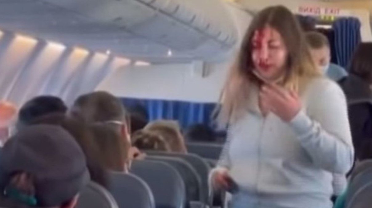 В самолёте Анталия — Запорожье подрались две пассажирки: одной из них разбили голову