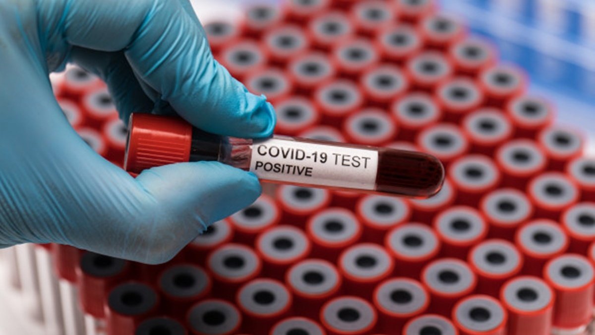 В Украине за сутки 1 703 новых случая коронавируса, умерли 64 человека