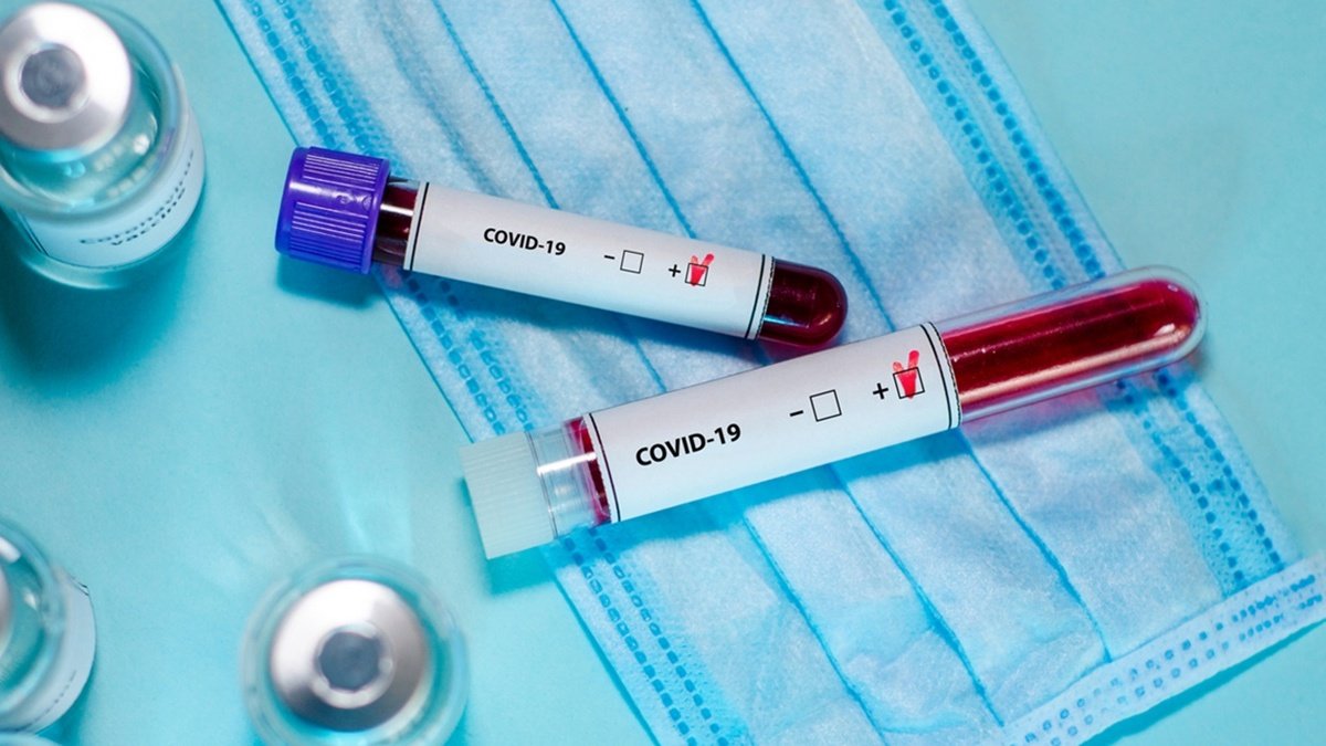 В Украине за сутки 2 137 новых случаев коронавируса, умерли 163 человека