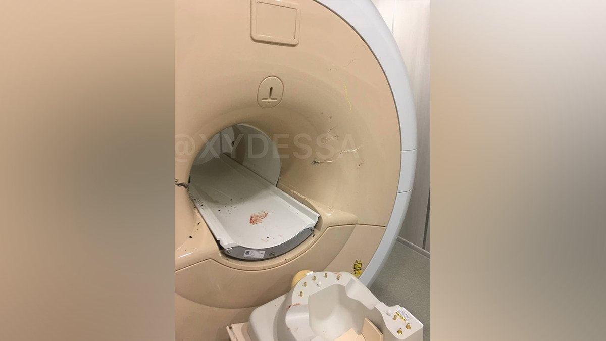 У медцентрі Одеси інвалідний візок затягнуло до апарату МРТ: постраждала жінка