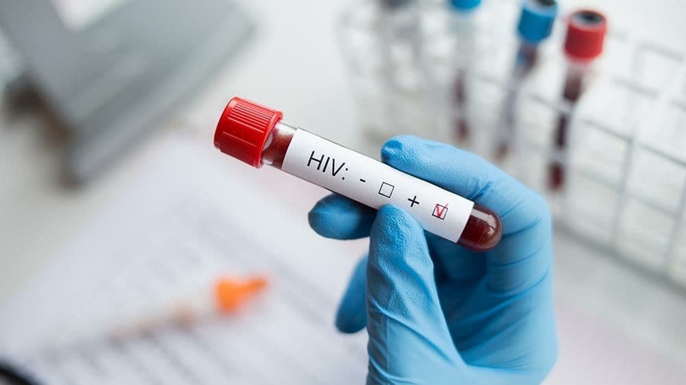 В Україні в травні зареєстрували 1 436 нових випадків ВІЛ-інфекції