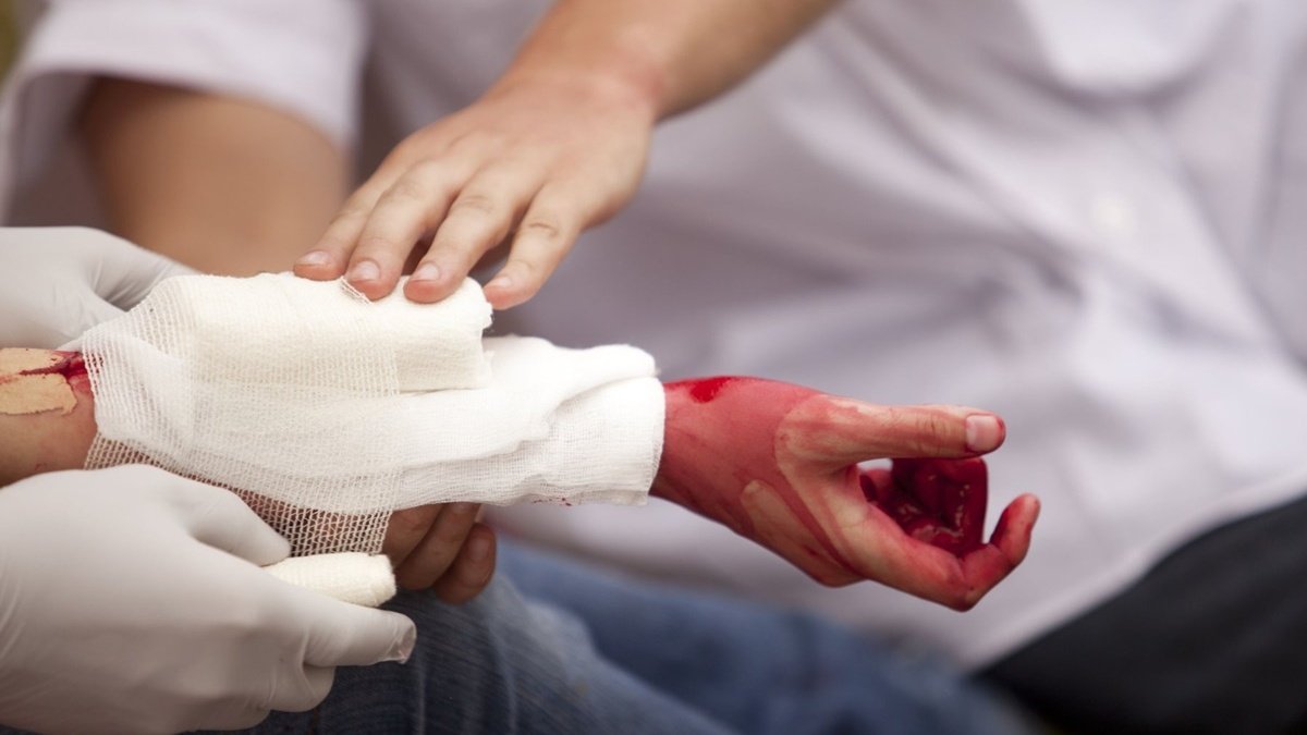Як допомогти людині з кровотечею