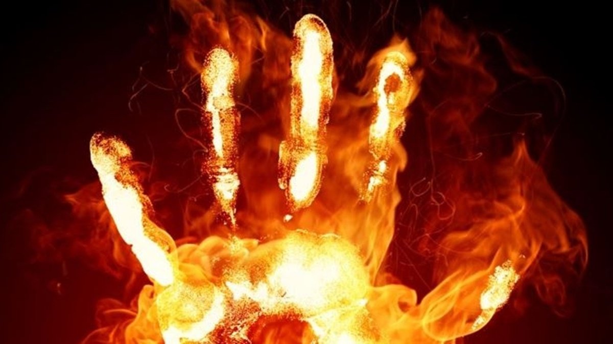 В Днепропетровской области 17-летняя девушка облилась горячей жидкостью: она в реанимации с сильными ожогами