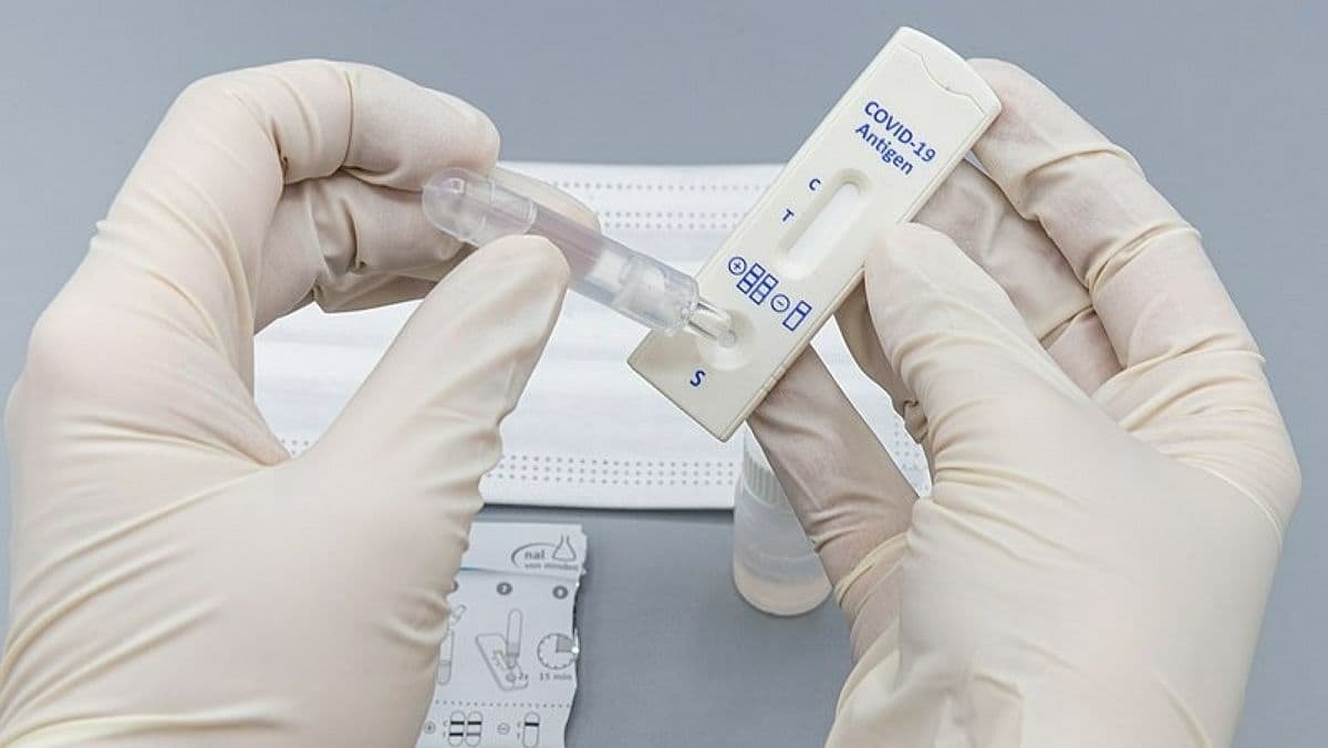 В Чехии не вакцинированные от коронавируса люди будут платить за COVID-тесты