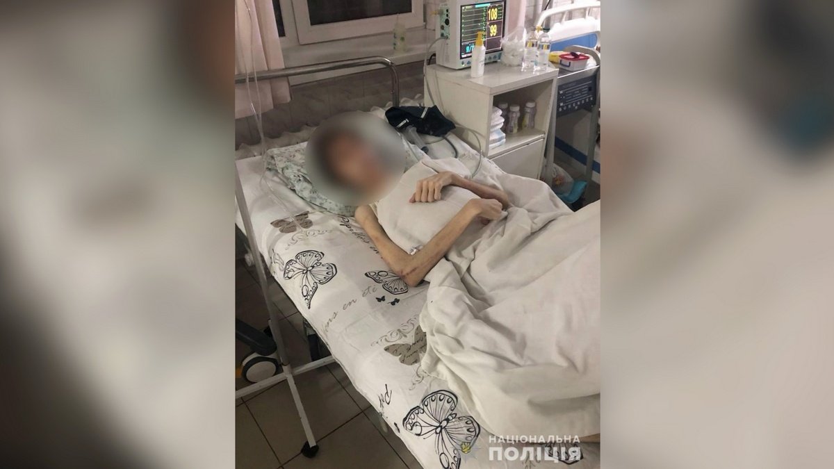 В Одесі чоловік заморив сина голодом, практикуючи "духовне лікування"