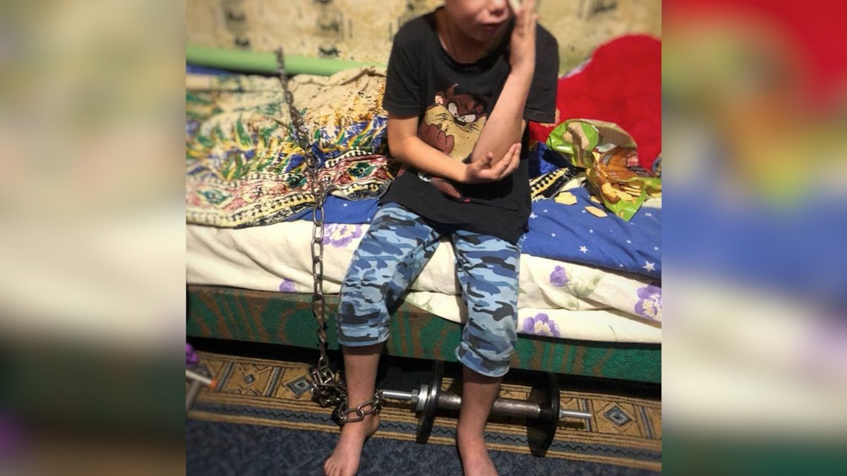 В Кривом Роге отчим приковал 7-летнего мальчика цепью к батарее, чтобы тот не сбежал из дома