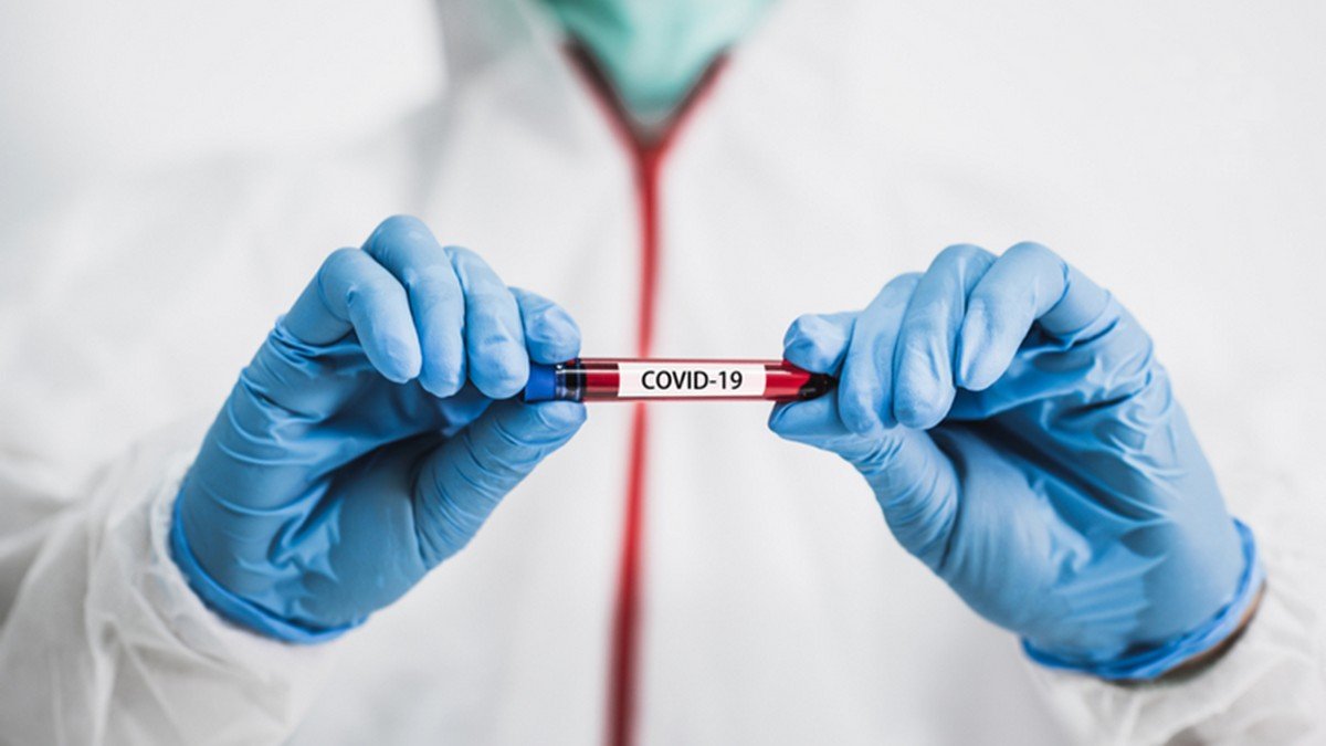В Україні за добу 827 нових випадків коронавірусу