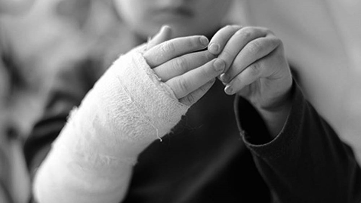 У Чернігівській області 2-річна дівчинка померла від опіків окропом: батьки не зверталися до лікарів