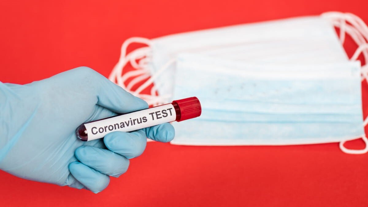 В Україні за добу 417 нових випадків коронавірусу