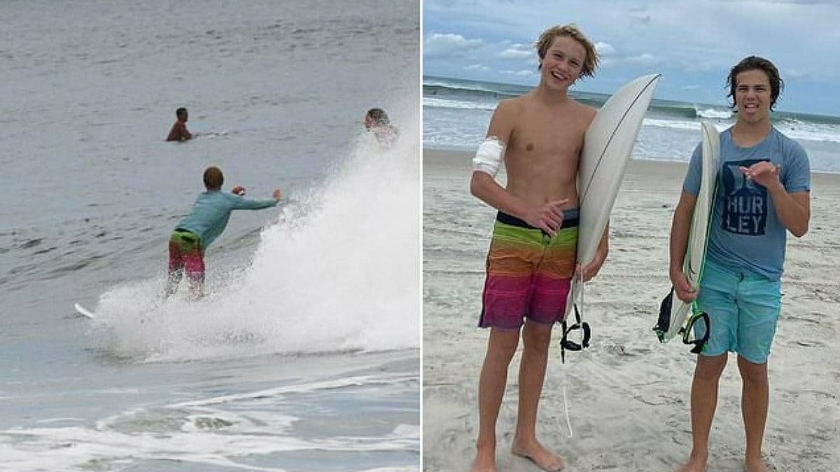 Во Флориде акула укусила подростка за руку: парень занимался серфингом