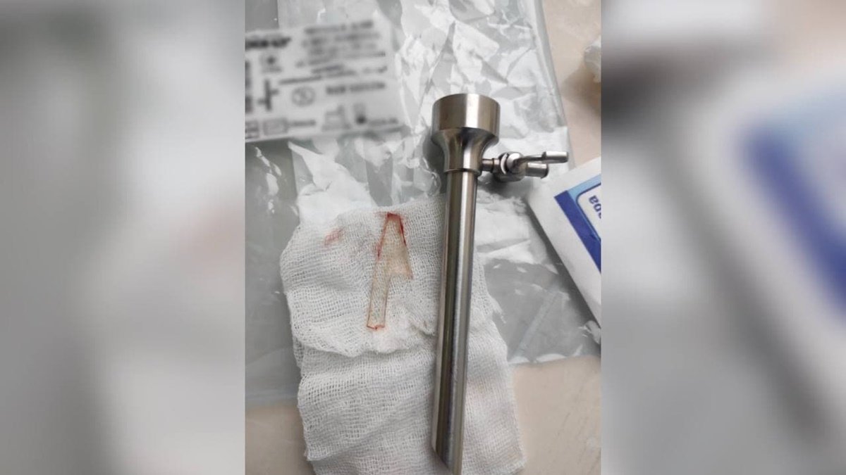 У Чернівцях 20-річний студент впав на електрочайник: шматок скла пробив легеню