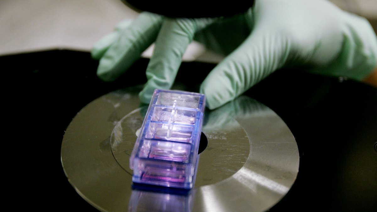 Учёные сделали фото штамма «Омикрон»: как он выглядит под микроскопом