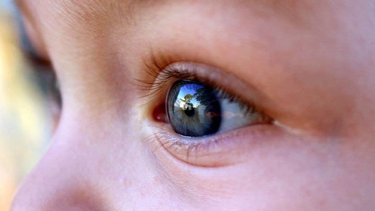 Во Львове врачи вытащили из глаза ребёнка 10-сантиметрового паразита