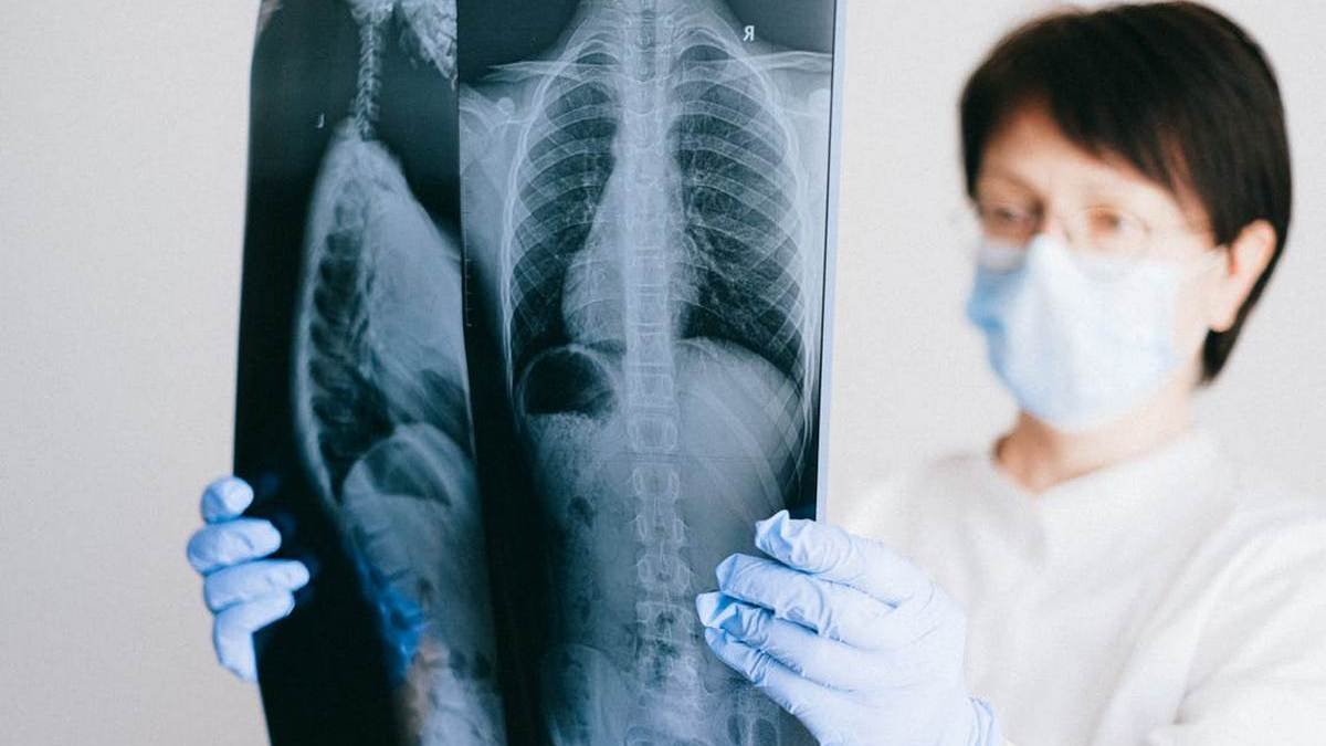 Украине грозит эпидемия туберкулёза: почему темпы распространения болезни продолжат расти