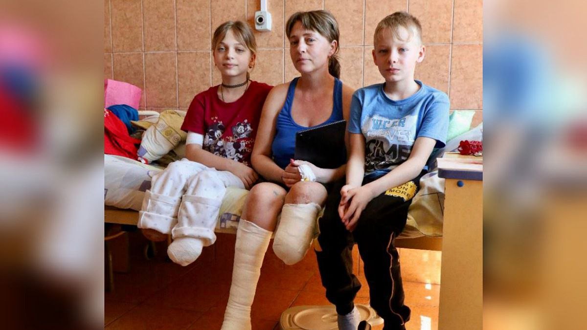 В Калифорнии установили протезы маме и дочери, которые потеряли ноги после обстрела вокзала в Краматорске.