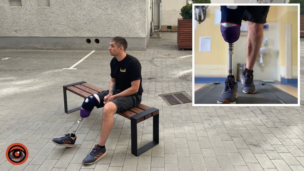 «Потерял ногу, спасая побратимов» — во Львове украинскому военному установили протез