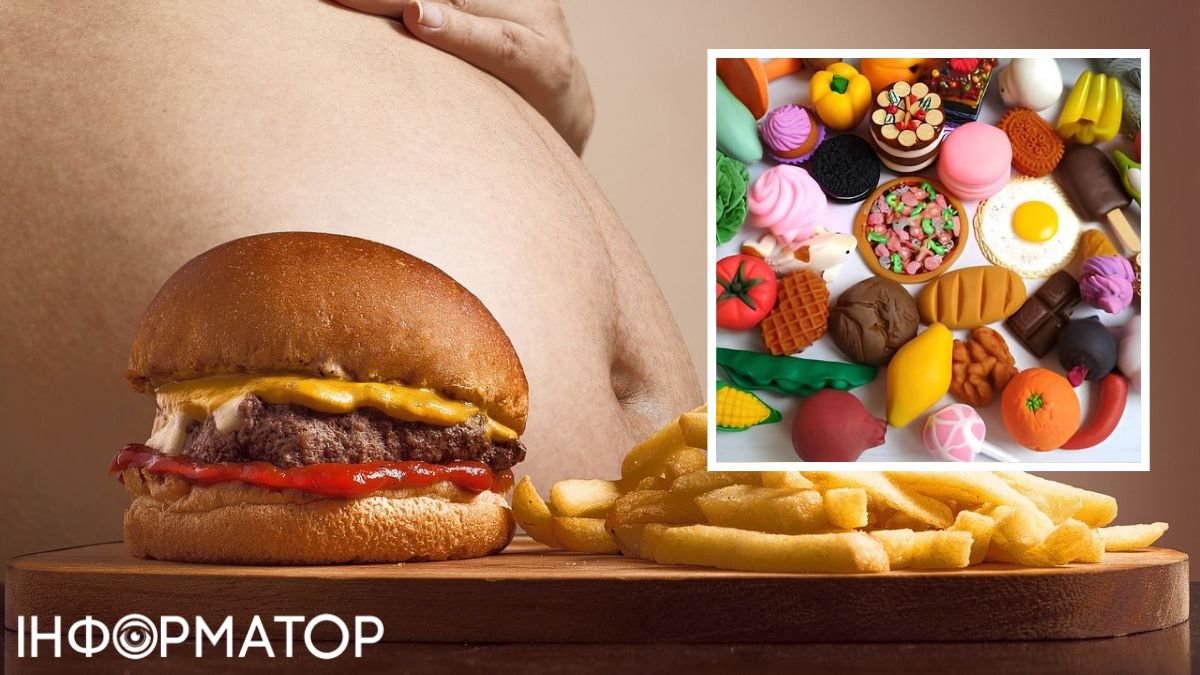 Ожиріння, причини