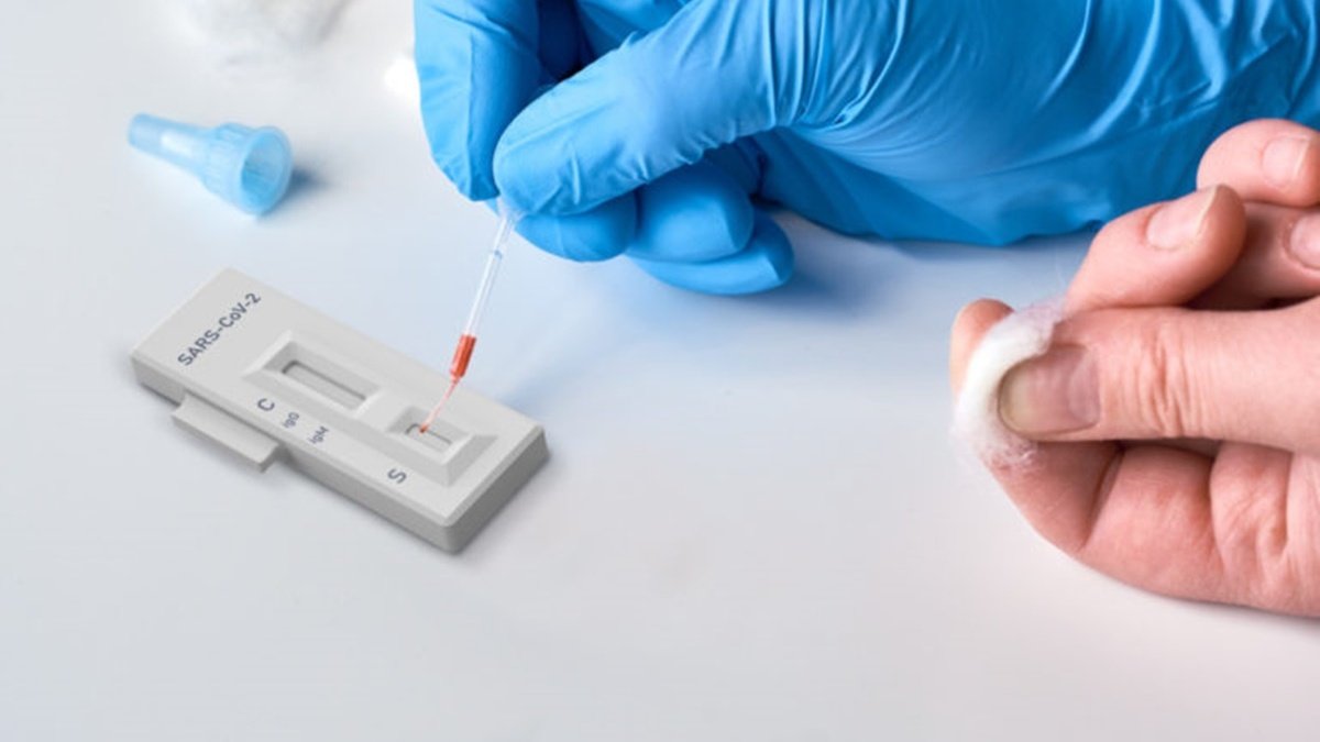 Експерти спростували достовірність тесту на антитіла до коронавірусу