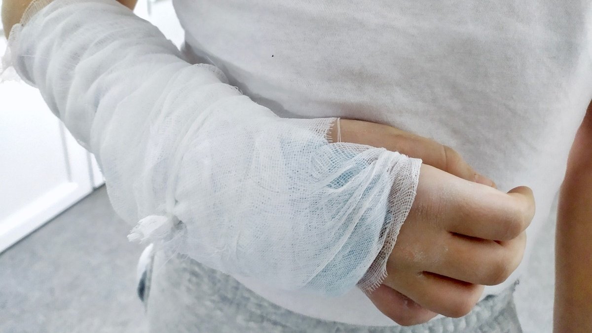 Во Львовской области 12-летний мальчик сделал неудачное сальто: у него перестала двигаться рука