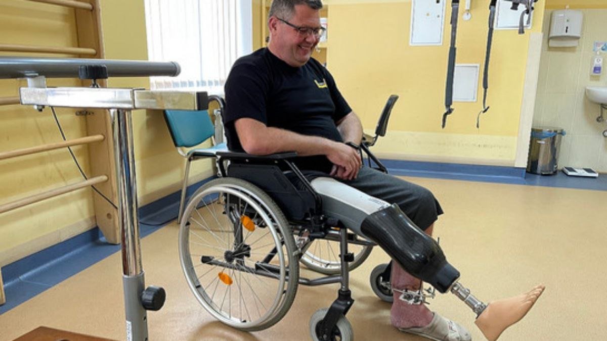 У Львові за 4 години виготовили та встановили протез чоловіку, який втратив ногу в Херсоні