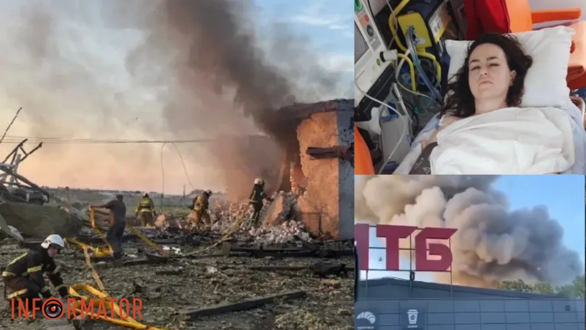 Потеряла ногу и находилась в коме: медики спасли женщину, пострадавшую во время атаки рф по Умани