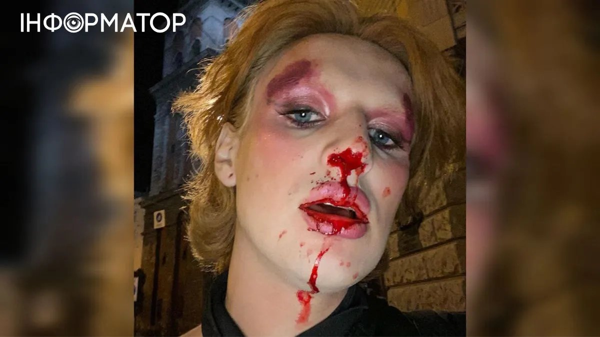 У центрі Львова побили трансгендерну військову: деталі